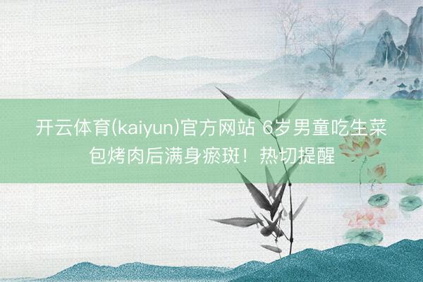 开云体育(kaiyun)官方网站 6岁男童吃生菜包烤肉后满身瘀斑！热切提醒